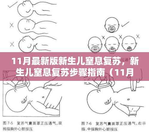 新生儿窒息复苏步骤指南,最新版初学者进阶版(11月版)