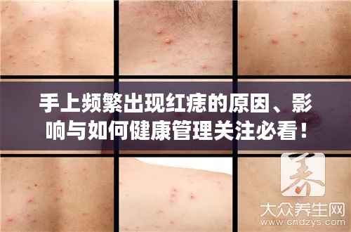 手上频繁出现红痣的原因、影响与如何健康管理关注必看!