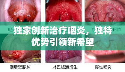 独家创新治疗咽炎，独特优势引领新希望